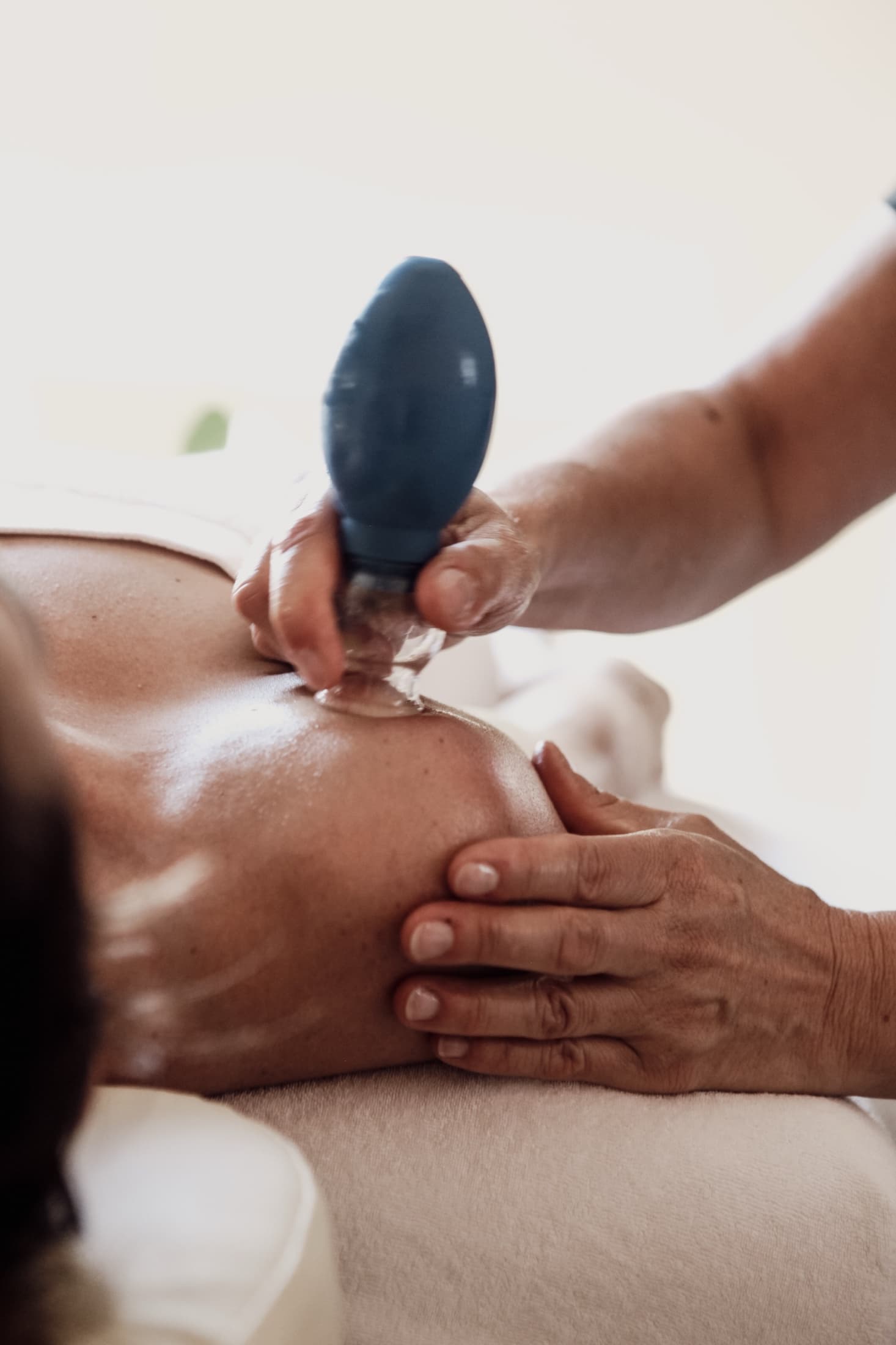Cuppingglazen op de schouder tijdens een Body CupHealing-behandeling